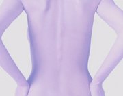 Leistenbruch, Hernien, Hernia, Hernia inguinalis